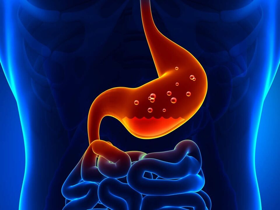 La gastrite è una malattia infiammatoria dello stomaco che richiede nutrizione